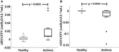 Reduced Baseline Airway Caliber Relates to Larger Airway Sensitivity to Rostral Fluid Shift in Asthma